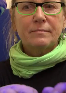 MBST Kernspinresonanz-Therapie Patientin